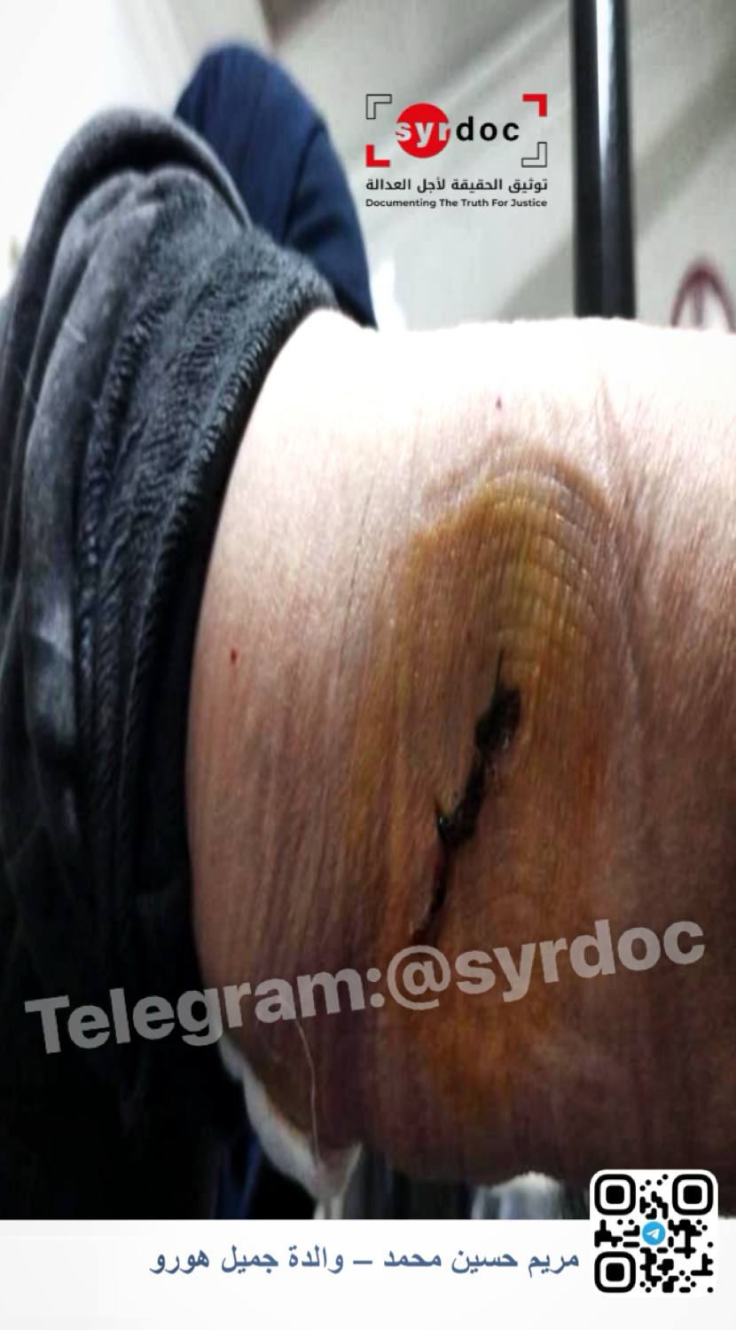 Evidence Image