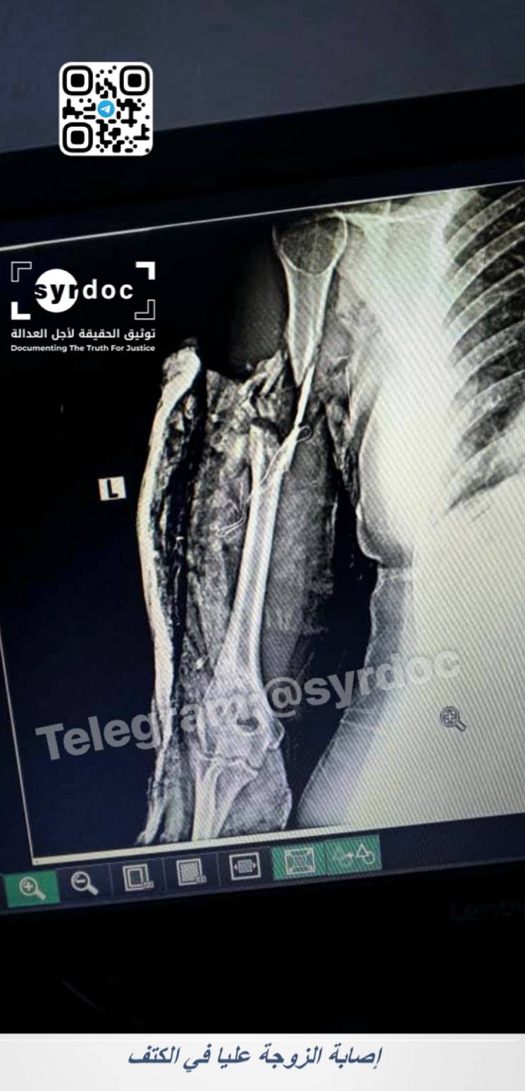 Evidence Image